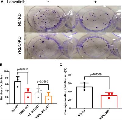 YRDC Mediates the Resistance of Lenvatinib in Hepatocarcinoma Cells via Modulating the Translation of KRAS